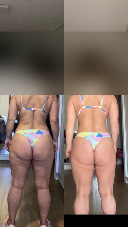 Registro de evolução de Betina